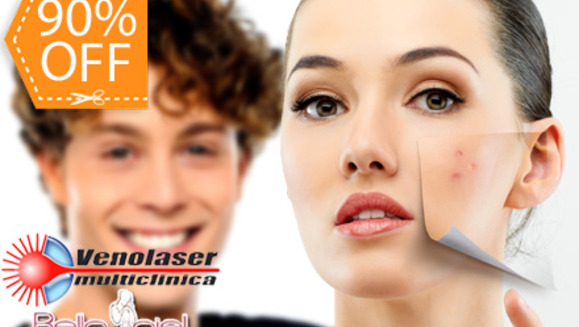 [Imagen:¡Dile “adiós” al acné! ¡Paga $99 en lugar de $950 por 4 sesiones de laser anti-acné y 4 faciales en Clínica Venolaser!]