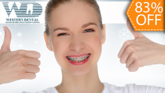 [Imagen:¡Logra una Sonrisa Perfecta! ¡Paga $99 en lugar de $575 por Colocación de Brackets Metálicos en Western Dental!]