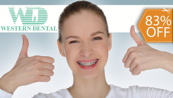 [Imagen:¿Quieres Tener Una Sonrisa Perfecta? ¡Paga $99 en vez de $575 por Colocación de Brackets Metálicos en Western Dental!]