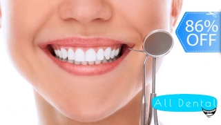 Limpieza Dental Completa con Ultrasonido + Pulido + Flúor y Más