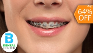 [Imagen:Colocación de Brackets Metálicos + Limpieza Dental y Más]