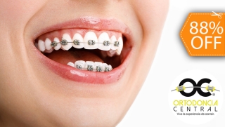 [Imagen:Brackets Metálicos + Limpieza Dental + 1 Consulta de Control]