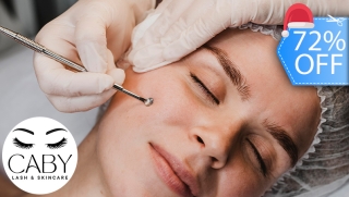 [Imagen:¡2 Sesiones de Limpieza Facial Profunda! Exfoliación, Peeling, Máscara LED, Extracción de Puntos, Altafrecuencia y Más.]