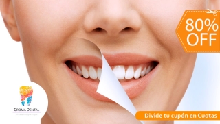 [Image: Blanqueamiento Dental + Limpieza Profunda y Másm]