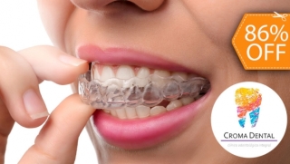 [Image: Férula Dental + Limpieza Dental con Sistema de Succión con Aerosol y Másm]