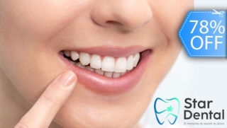 [Image: Blanqueamiento Dental Químico con Luz LED + Limpieza Dental y de Manchas y Másm]