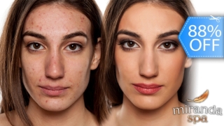 [Image: Facial Antiacné con Limpieza Profunda + Extracción y Másm]