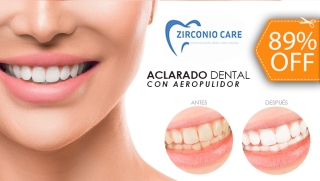 [Image: Aclarado Dental con Aeropulidor + Limpieza Dental con Ultrasonido y Másm]