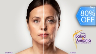 [Image: Facial Anti-Aging: Fototerapia + Limpieza Facial + Sérum de Retinol y Másm]