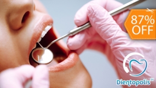 [Image: 3 Rellenos Dentales o 4 Sellantes + Limpieza con Ultrasonido y Másm]