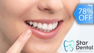 [Image: Blanqueamiento Dental Químico-LED, Limpieza con Ultrasonido, Remoción de Manchas y Más.m]