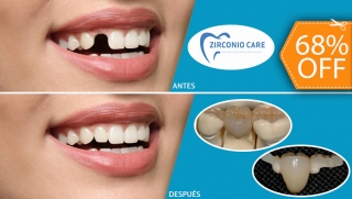 [Image: 1 Pieza Dental de Zirconio, Resina y Porcelana (Sin Metales) + Limpieza con Ultrasonidom]