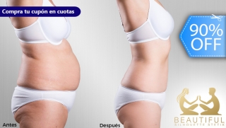 [Image: ¡Nueva Figura en 4 Semanas! Tratamiento Reductivo - Anti-Obesidad "Cuerpo Completo" Mesoterapias, Masajes y Masm]