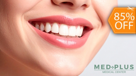 [Image: Limpieza Dental con Ultrasonido + Pulido Dental + Aplicación de Flúor y Másm]