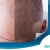 [Imagen:¡Libérate de la Calvicie! ¡Paga $199 en vez de $900 por 3 Sesiones de Plasma Rico en Plaquetas para Alopecia (Calvicie)!]
