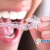 [Image: ¡Paga Q99 en lugar de Q950 por Guarda-Retenedor para Tratamiento Contra Rechinado de Dientes (Bruxismo), Tratamientos Post-Ortodoncia, Implantes Dentales o Coronas + Evaluación Dental!m]