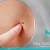 [Image: ¡Paga $20 en Lugar de $100 por Eliminación de hasta 20 Verrugas o Cabezas de Vena en Cuello, Axilas o Rostro + Consulta Dermatológica!m]