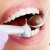 [Image: ¡Paga Q99 en lugar de Q300 por 1 Relleno Dental de Resina (Sustitución de Amalgama)!m]