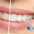 [Imagen:¡Paga Q395 en lugar de Q1,100 por Blanqueamiento Dental Químico con Luz LED + Pulido Dental + Aplicación de Flúor!]