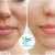 [Image: ¡Paga Q999 en lugar de Q4,500 por Lifting de Párpados (Superiores o Inferiores) o del Labio Superior (Código de Barras) con Plasma Láser!m]