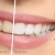 [Imagen:¡Paga $50 en Lugar de $310 por Blanqueamiento Dental Químico con Luz LED + Limpieza Dental (Detartraje) + Consulta Odontológica!]