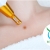 [Image: ¡Paga Q149 en lugar de Q900 por Cauterización Láser de hasta 20 Cabezas de Vena o 4 Lunares o 4 Verrugas (de hasta 5 mm) + Evaluación Médica!m]
