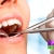 [Image: ¡Paga Q85 en lugar de Q400 por Limpieza Dental Completa con Eliminación de Sarro y Manchas con Ultrasonido + Pulido Dental con Profijet + Aplicación de Flúor y Examen Diagnóstico con Radiografías Digitales!m]