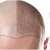 [Image: ¡Recupera tu Hermosa Cabellera! ¡Paga Q299 en lugar de Q1,500 por 2 Sesiones de Plasma Rico en Plaquetas + Terapia de Luz LED para Alopecia (Calvicie)!m]