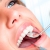 [Image: ¡Paga Q89 en Lugar de Q500 por Limpieza Dental Completa con Eliminación de Sarro + Pulido con Profijet + Aplicación Tópica de Flúor + Examen de Diagnóstico Completo y Evaluación!m]