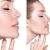 [Image: ¡Paga Q1,899 en Lugar de Q11,000 por Rinomodelación o Rejuvenecimiento Facial con Hilos Tensores + PRP + Aplicación de Ácido Hialurónico o Plasma Gel + 1 Limpieza Facial Profunda + Microdermoabrasión + Evaluación!m]