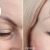 [Image: ¡Paga Q499 en Vez de Q2,500 Blefaroplastia Sin Cirugía con Tecnología Plasma PlexR para Eliminar Párpados Caídos, Arrugas, Manchas, Lunares y Marcas de Acné + Rejuvenecimiento con Relleno Plasma Gel en Entrecejo, Patas de Gallo o Surco Nasogeniano!m]