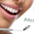[Image: ¡Paga $60 en Lugar de $215 por 2 Aplicaciones de Blanqueamiento Dental con Luz LED en 1 Sola Sesión + Limpieza Dental!m]