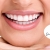 [Image: ¡Paga $60 en Lugar de $155 por 2 Aplicaciones de Blanqueamiento Dental con Luz LED en 1 Sola Sesión + Limpieza Dental!m]