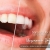 [Image: ¡Paga Q449 en Lugar de Q3,598 por Blanqueamiento Dental con Luz LED + Limpieza Ultrasónica Profunda con Eliminación de Sarro y de Manchas de Colorantes con Pulido Profiject + Sistema de Detección de Bacterias Dentales!m]