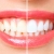 [Image: ¡Paga $50 en Lugar de $225 por Blanqueamiento Dental Químico con Luz LED + Limpieza Profunda con Ultrasonido (Detartraje) + Consulta Odontológica + Aplicación de Refuerzo y Más!m]