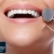 [Image: ¡Paga $25 en Lugar de $135 por 3 Rellenos o 4 Sellantes + Limpieza con Ultrasonido + Aplicación de Flúor + Diagnóstico con Cámara Intraoral + Evaluación de Ortodoncia!m]