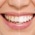 [Image: ¡Paga Q449 en Lugar de Q3,598 por Blanqueamiento Dental con Luz LED + Limpieza Ultrasónica Profunda con Eliminación de Sarro y de Manchas de Colorantes con Pulido Profiject + Diagnóstico Integral Completo con Radiografías y Fotografías Digitales!m]