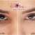 [Image: ¡Paga Q150 en lugar de Q750 por Reducción de Ojeras y Bolsas en Los Ojos con Terapia Intradérmica!m]