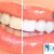 [Image: ¡Paga Q395 en vez de Q1,500 por Blanqueamiento Dental Láser + Limpieza y Pulido Dental con Profilaxis + Eliminación de Sarro con Ultrasonido + Aplicación Tópica de Flúor + Examen Diagnóstico en Dental Life!m]