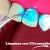 [Image: ¡Paga Q85 en lugar de Q500 por Limpieza Dental con Ultrasonido + Pulido Dental con Profijet + Aplicación de Flúor + Examen de Diagnóstico con Radiografías Digitales!m]