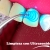 [Image: ¡Paga $25 en Lugar de $180 por 3 Rellenos de Resina o 4 Sellantes + Radiografía + Limpieza Dental con Ultrasonido + Aplicación de Flúor + Consulta y Diagnóstico Bucodental con Cámara Intraoral + Evaluación de Cordales!m]