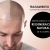 [Image: ¡Paga $199 en Lugar de $740 por 3 Sesiones de Plasma Rico en Plaquetas para Calvicie o Rejuvenecimiento Facial + 3 Limpiezas de Rostro + 3 Mascarillas de Ozono o Carbón Activado + 3 Microneedling + 6 Mascarillas Vampiro con Colágeno Puro y Más!m]