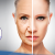 [Imagen:¡Paga $199 en Lugar de $1,050 por Rejuvenecimiento Facial con 3 Plasmas Ricos en Plaquetas + 3 Microdermoabrasiones + 3 Mascarillas de Preparación y 3 Mascarillas Relajantes!]