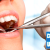 [Imagen:¡Paga $20 en Lugar de $125 por 2 Rellenos Dentales o 3 Sellantes + Limpieza con Ultrasonido + Aplicación de Flúor + Evaluación de Cordales + Consulta y Diagnostico!]