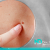 [Imagen:¡Paga $20 en Lugar de $100 por Eliminación de hasta 20 Verrugas o Cabezas de Vena en Cuello, Axilas o Rostro + Consulta Dermatológica!]