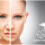 [Imagen:¡Paga $199 en Lugar de $1,050 por Rejuvenecimiento Facial con 3 Plasmas Ricos en Plaquetas + 3 Microdermoabrasiones + 3 Mascarillas de Preparación y 3 Mascarillas Relajantes!]