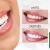 [Imagen:¡Paga $69 en Lugar de $265 por Blanqueamiento Dental con Lámpara UV + Limpieza con Ultrasonido + Aplicación de Gel Desensibilizante!]
