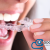 [Imagen:¡Paga $18 en Lugar de $75 por Férula Dental para Tratamiento Contra Rechinado de Dientes (Bruxismo) + Evaluación Dental + Limpieza con Ultrasonido + Aplicación Tópica de Flúor!]