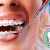 [Imagen:¡Paga $75 en Lugar de $200 por Colocación de Brackets Metálicos + Evaluación y Diagnóstico Clínico + Fotografías y Modelo de Estudio!]