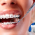 [Imagen:¡Paga Q549 en lugar de Q2,200 por Colocación de Brackets Metálicos Superiores e Inferiores + Evaluación y Diagnóstico + Limpieza Dental + Fotografías y Modelo de Estudio!]